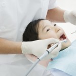 歯の治療写真